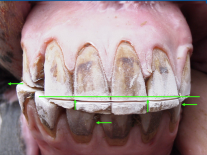 Front teeth